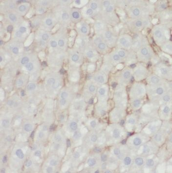 SCD Antibody