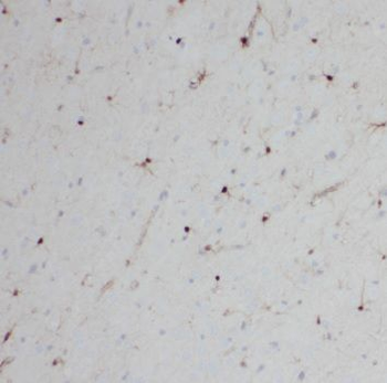 SCGB2B2 Rabbit Polyclonal Antibody