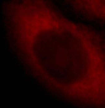SCIN Antibody