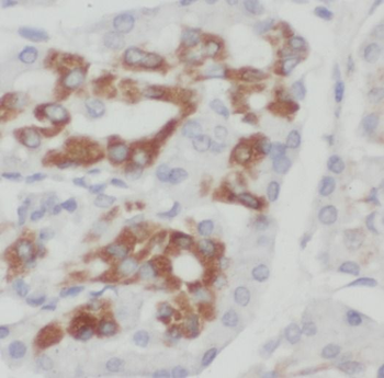 SCIN Antibody