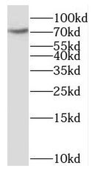 SCLT1 Rabbit Polyclonal Antibody