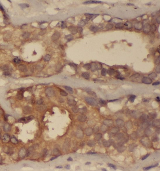 SCLY Antibody
