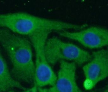 SCN10A Rabbit Polyclonal Antibody
