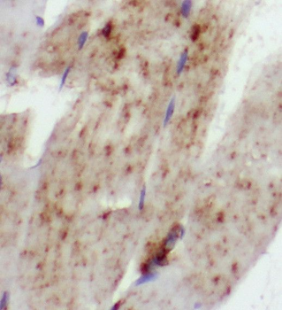 SCN4B Antibody