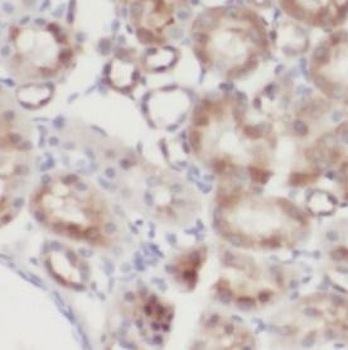 SCNN1A Rabbit Polyclonal Antibody