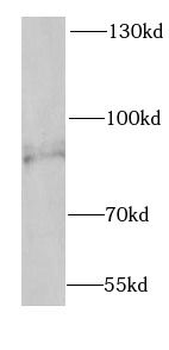 SCNN1G Antibody