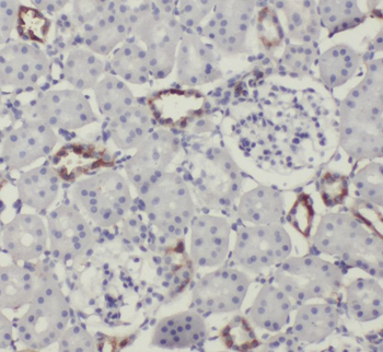 SCUBE3 Antibody