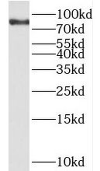 SCYL3 Rabbit Polyclonal Antibody