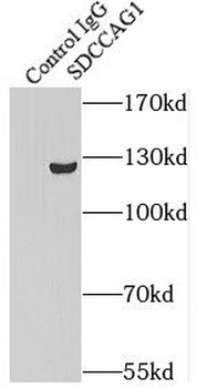 NEMF Antibody