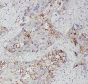 NEMF Antibody