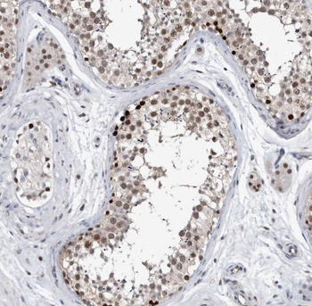 SDF2L1 Antibody