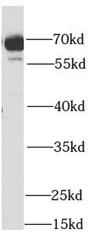 SDHA Antibody