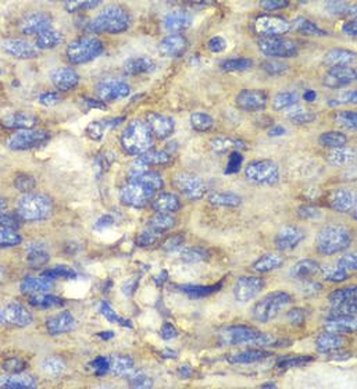 SDHA Antibody