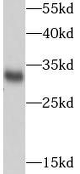 SDHB Antibody