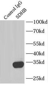 SDHB Antibody