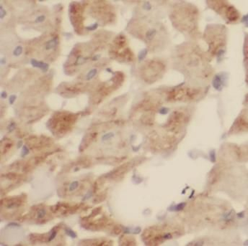 SDHB Antibody