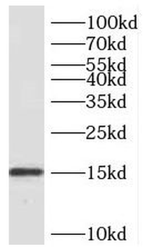 SDHC Antibody