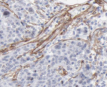 SDHC Antibody