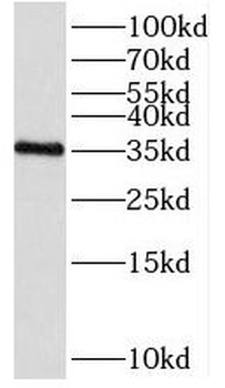 SDR39U1 Antibody