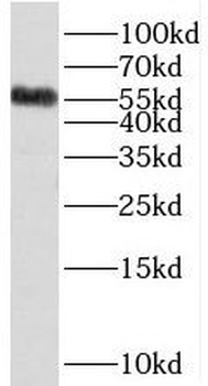 SDSL Antibody