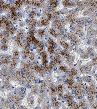 SDSL Antibody