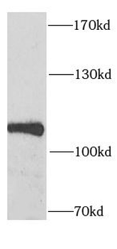 SECISBP2 Antibody