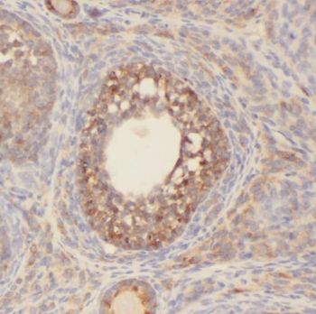 SENP1 Antibody
