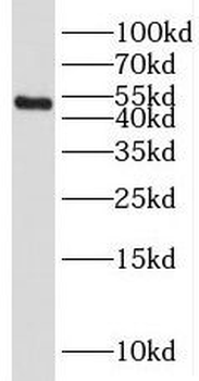 SERPINA6 Rabbit Polyclonal Antibody