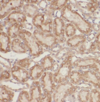 SERPINA6 Rabbit Polyclonal Antibody