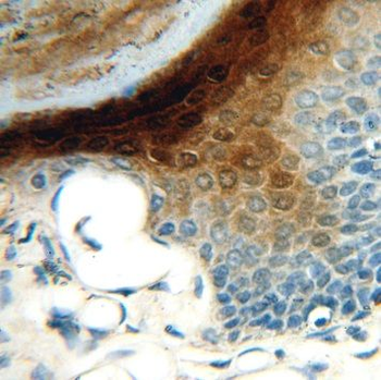 SERPINB13 Rabbit Polyclonal Antibody