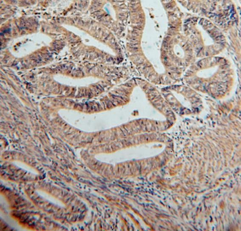 SERPINB2 Antibody