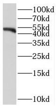 SERPINB8 Rabbit Polyclonal Antibody