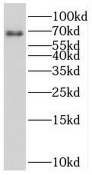 SESN1 Antibody