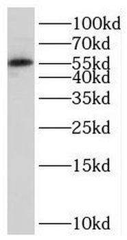 SESN3 Rabbit Polyclonal Antibody