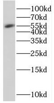 SESN3 Rabbit Polyclonal Antibody