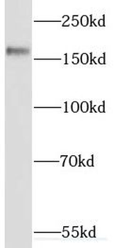 SETBP1 Antibody