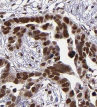 SETD1B Antibody
