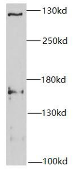 SETD2 Antibody