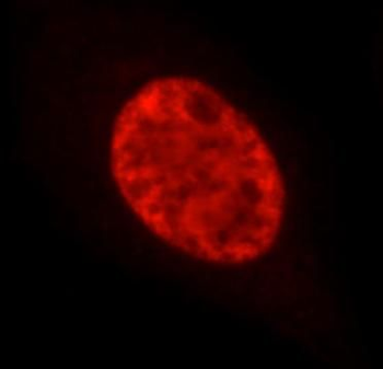 SETD2 Antibody