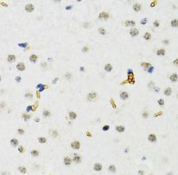 SETDB1 Antibody