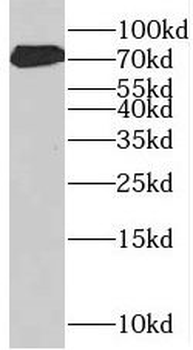 SUGP1 Rabbit Polyclonal Antibody