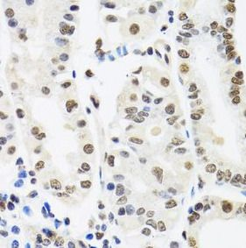 SFPQ Antibody