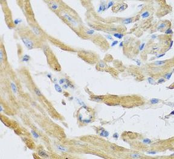 SFRP4 Antibody
