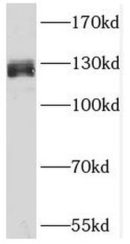 SUGP2 Antibody