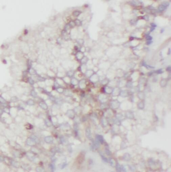 SUGP2 Antibody