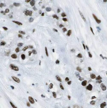 AKAP17A Antibody