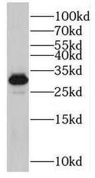 SRSF2 Antibody
