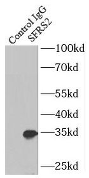 SRSF2 Antibody
