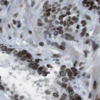 SRSF7 Antibody
