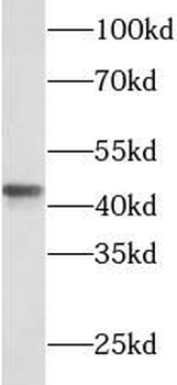 SFTPB Antibody
